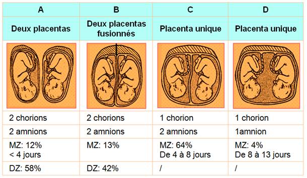 Jumeaux Monzygotes Et Dizygotes